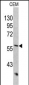 KRT10 Antibody (Center)