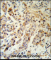 KRT13 Antibody (N-term)