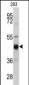 KRT13 Antibody (N-term)