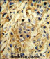 TIMP1 Antibody (N-term)