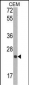 TIMP1 Antibody (N-term)