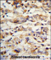 KRT14 Antibody (Center)