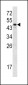 SERPINA7 Antibody (C-term)