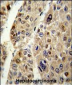SERPINC1 Antibody (C-term)