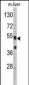 SERPINC1 Antibody (C-term)