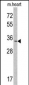 MLF1 Antibody (N-term)