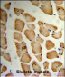 MVD Antibody (N-term)