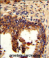 KRT4 Antibody (C-term)