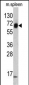 KRT4 Antibody (C-term)