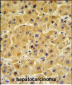 F10 Antibody (C-term)