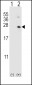 HPRT1 Antibody (C-term)