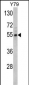 Fascin Antibody (Center)