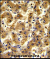 ADH1B Antibody (Center)
