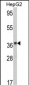 ADH1B Antibody (Center)