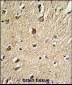 BGN Antibody (Center)