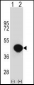 BGN Antibody (Center)