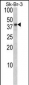 BGN Antibody (Center)