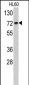 TOMM70A Antibody (C-term)