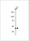 FGG Antibody (N-term)