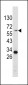 Tyrosinase Antibody (C-term)