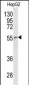 NUP62 Antibody (C-term E507)