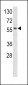 RYK Antibody (Center C397)