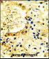 ACK1 Antibody (N-term)