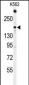 ACK1 Antibody (N-term)