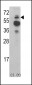 ACK1 Antibody (N-term)