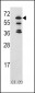 ACK1 Antibody (Center)