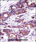 NPM1 Antibody (C-term)