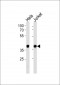 NPM1 Antibody (C-term)