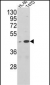 AHSA1 Antibody (N-term)