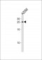 APRT Antibody (N-term)