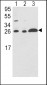 ARHGDIA Antibody (C-term)