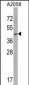 EIF3S5 Antibody (N-term)