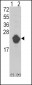 IL1RN Antibody (Center)