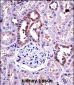 M-CSF Antibody (Center)
