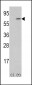 M-CSF Antibody (Center)