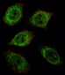 UCHL1 Antibody (C-term)