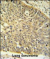 MTHFD1 Antibody (Center P550)