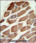 ACTR3 Antibody (C-term)