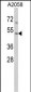 ACTR3 Antibody (C-term)