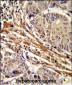 APRT Antibody (C-term)