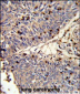 CFL1 Antibody (N-term)
