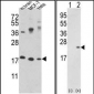 CFL1 Antibody (N-term)