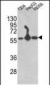 P4HB Antibody (C-term)