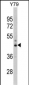 PSMD13 Antibody (C-term)