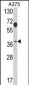 PSMD7 Antibody (N-term)