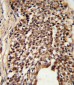 TPI1 Antibody (N-term)